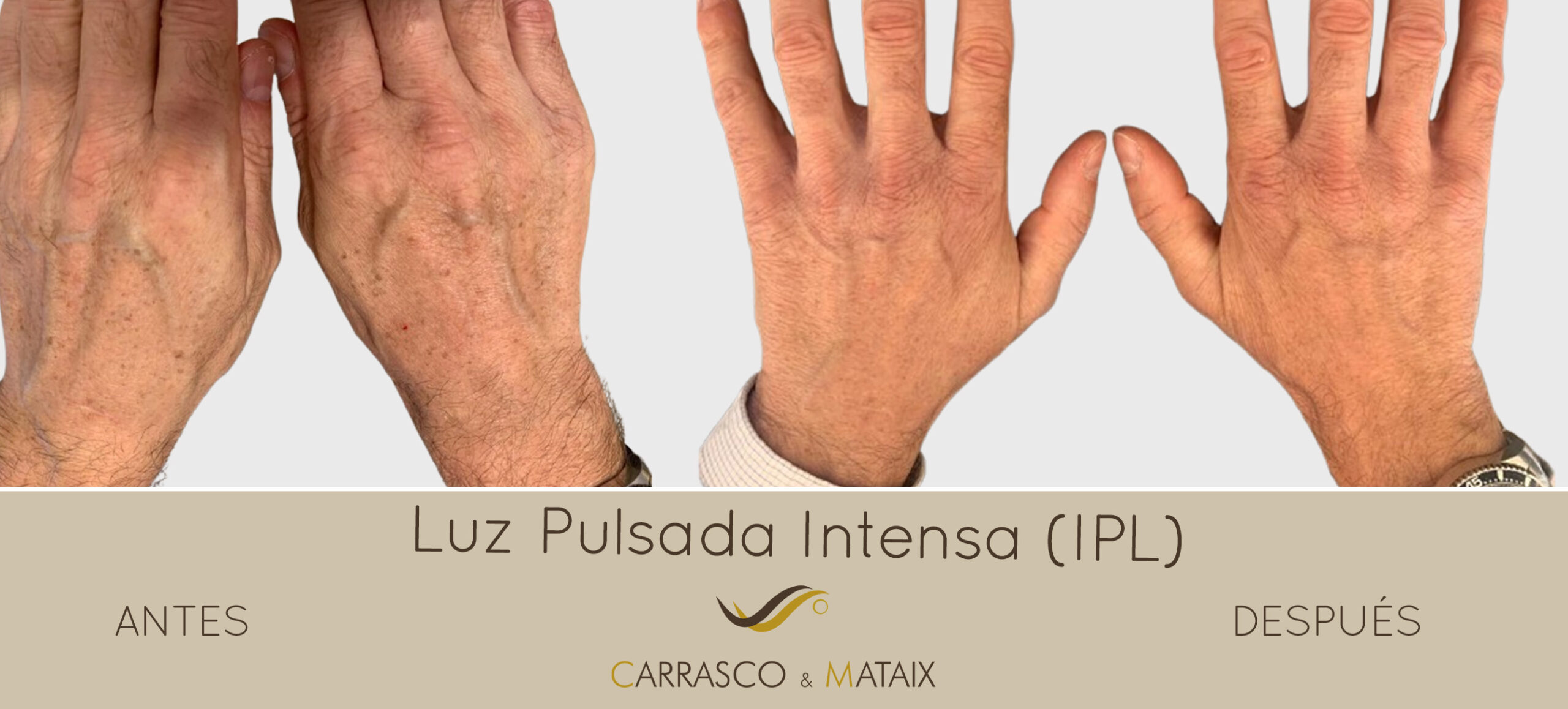 Imagen oculta