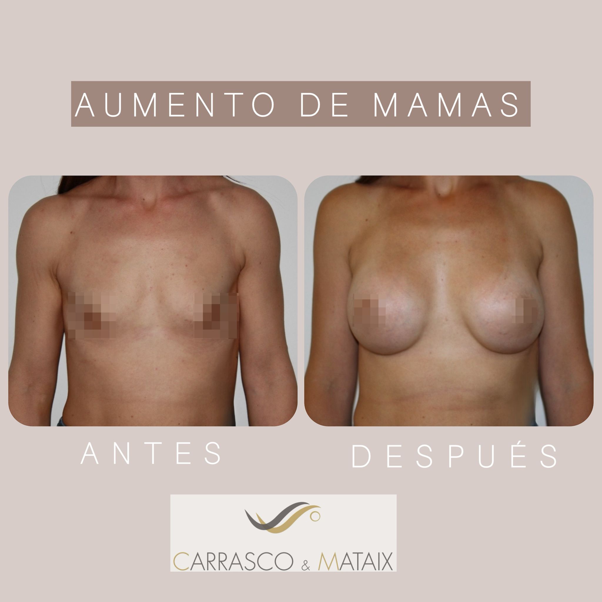 Imagen oculta