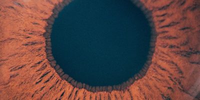 glaucoma fondo sevilla